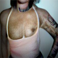 transgender person