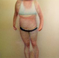 transgender person